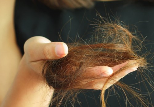 Is hair loss from weight loss permanent?